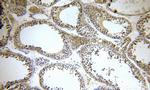 KLHL12 Antibody in Immunohistochemistry (Paraffin) (IHC (P))