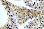 KLHL12 Antibody in Immunohistochemistry (Paraffin) (IHC (P))