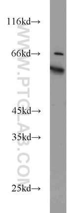 KLHL12 Antibody in Western Blot (WB)