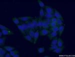 GOT1 Antibody in Immunocytochemistry (ICC/IF)