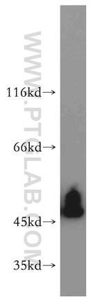 GOT1 Antibody in Western Blot (WB)