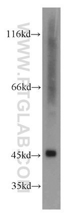 GOT1 Antibody in Western Blot (WB)