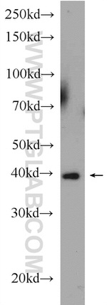 GOT1 Antibody in Western Blot (WB)