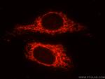 GRP75 Antibody in Immunocytochemistry (ICC/IF)