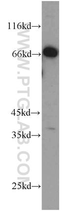 C1orf116 Antibody in Western Blot (WB)