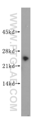 GSTZ1 Antibody in Western Blot (WB)