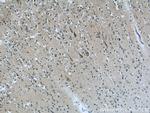 ABI2 Antibody in Immunohistochemistry (Paraffin) (IHC (P))