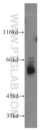 ABI2 Antibody in Western Blot (WB)