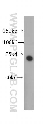 ABI2 Antibody in Western Blot (WB)