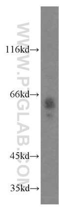 ABI2 Antibody in Western Blot (WB)