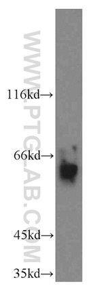 ABI2 Antibody in Western Blot (WB)