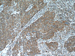 ATP5D Antibody in Immunohistochemistry (Paraffin) (IHC (P))