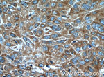 ATP5D Antibody in Immunohistochemistry (Paraffin) (IHC (P))