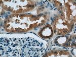 ATP5D Antibody in Immunohistochemistry (Paraffin) (IHC (P))