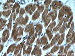 RBX1 Antibody in Immunohistochemistry (Paraffin) (IHC (P))