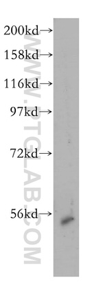 RRP1 Antibody in Western Blot (WB)