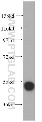 RRP1 Antibody in Western Blot (WB)