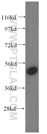 RRP1 Antibody in Western Blot (WB)