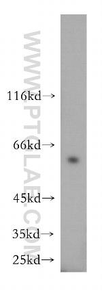 NAP1L1 Antibody in Western Blot (WB)