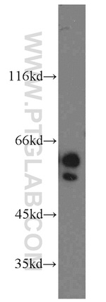 NAP1L1 Antibody in Western Blot (WB)