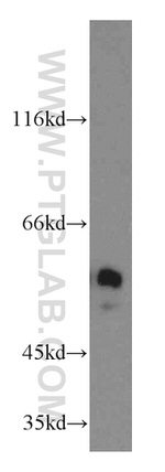 NAP1L1 Antibody in Western Blot (WB)