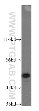 NAP1L1 Antibody in Western Blot (WB)