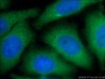 PSMD4 Antibody in Immunocytochemistry (ICC/IF)