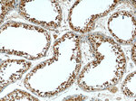 PSMD4 Antibody in Immunohistochemistry (Paraffin) (IHC (P))