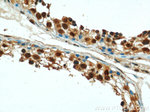 PSMD4 Antibody in Immunohistochemistry (Paraffin) (IHC (P))