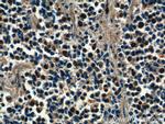 PSMD4 Antibody in Immunohistochemistry (Paraffin) (IHC (P))