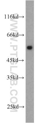 PSMD4 Antibody in Western Blot (WB)