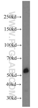 PSMD4 Antibody in Western Blot (WB)