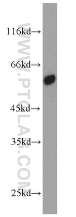 PSMD4 Antibody in Western Blot (WB)