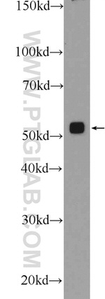 PSMD4 Antibody in Western Blot (WB)