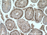 AARSD1 Antibody in Immunohistochemistry (Paraffin) (IHC (P))