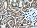 AARSD1 Antibody in Immunohistochemistry (Paraffin) (IHC (P))