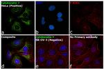 Cytokeratin 7 Antibody