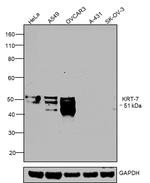 Cytokeratin 7 Antibody in Western Blot (WB)