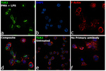 CD282 (TLR2) Antibody in Immunocytochemistry (ICC/IF)