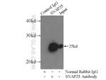 SNAP25 Antibody in Immunoprecipitation (IP)