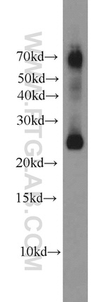 SNAP25 Antibody in Western Blot (WB)