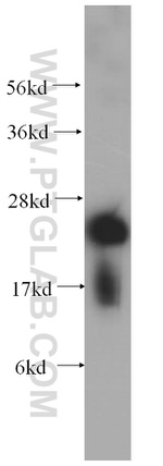 SNAP25 Antibody in Western Blot (WB)