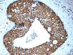 PSMC2 Antibody in Immunohistochemistry (Paraffin) (IHC (P))