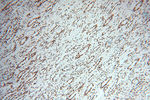 PSME3 Antibody in Immunohistochemistry (Paraffin) (IHC (P))