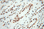 PSME3 Antibody in Immunohistochemistry (Paraffin) (IHC (P))