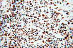 PSME3 Antibody in Immunohistochemistry (Paraffin) (IHC (P))