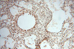 PSME3 Antibody in Immunohistochemistry (Paraffin) (IHC (P))