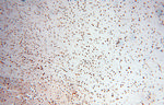 PSME3 Antibody in Immunohistochemistry (Paraffin) (IHC (P))