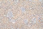 PSME3 Antibody in Immunohistochemistry (Paraffin) (IHC (P))