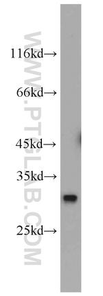 QDPR Antibody in Western Blot (WB)